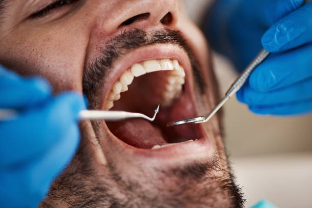 Best Emergency Dentist for Knocked-Out Tooth in Polo, IL